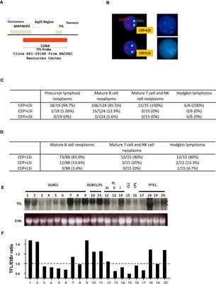 Tfl deletion induces extraordinary Cxcl13 secretion and cachexia in VavP-Bcl2 transgenic mice